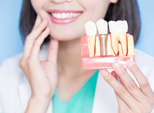 Dentist holding model implant in foreground while touching her own jaw in background