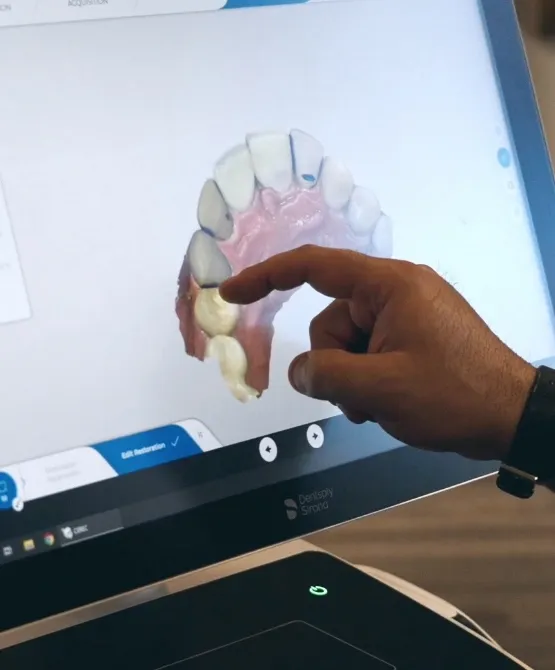 Dentist gesturing to a screen showing a digital model of a row of teeth