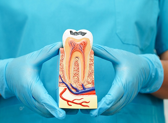 Dentist holding cross-section model of tooth